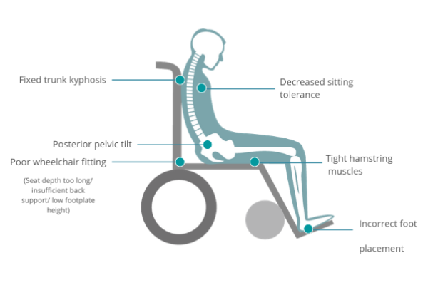 What Happens to the Elderly User if the Seat Depth of the Wheelchair Is ...