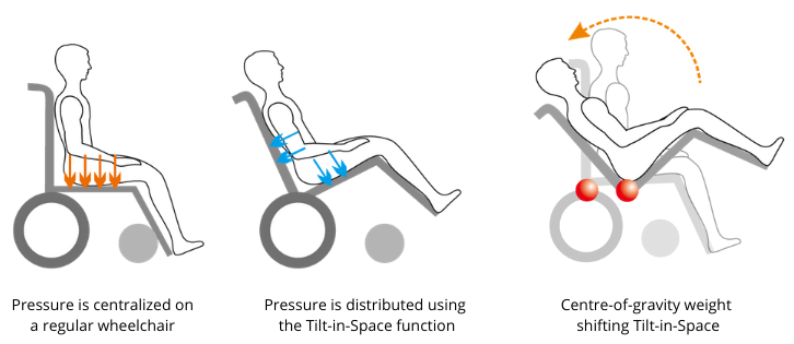 How to Buy a Reclining and Tilting Wheelchair | KARMA Medical